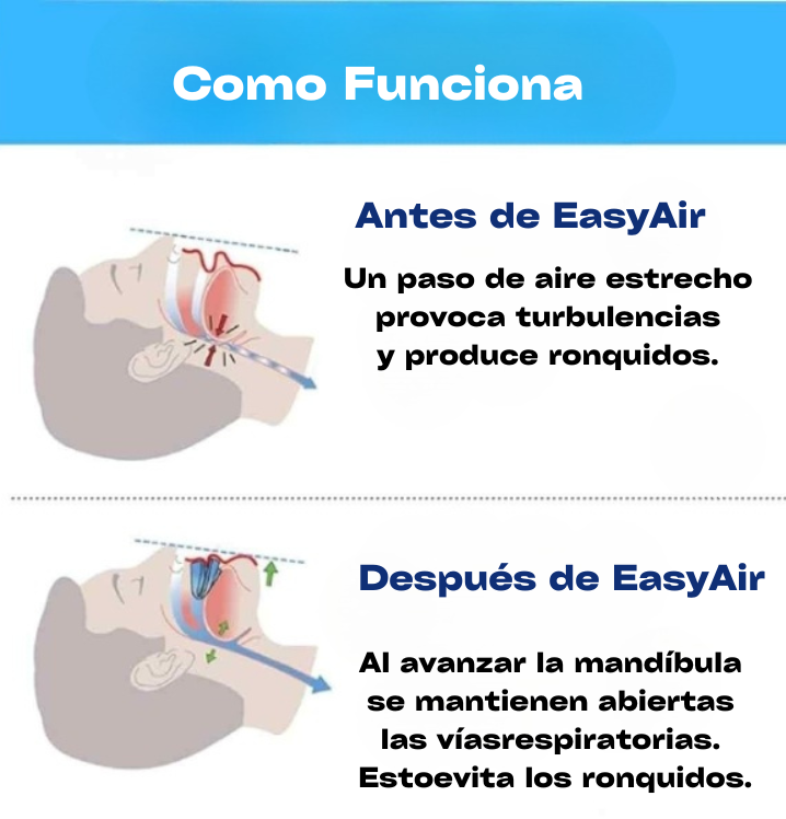 LA BOQUILLA ANTIRONQUIDOS EASYAIR