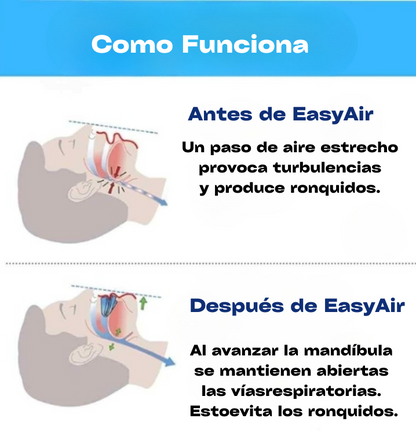 LA BOQUILLA ANTIRONQUIDOS EASYAIR